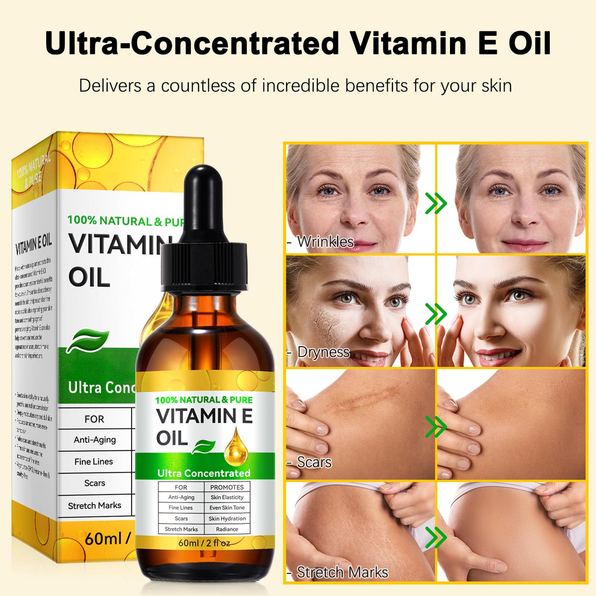 flasture Vitamin E Oil 75,000 IU – 100% Pure Natural Vitamin E for Skin, Face, Hair, Scars – Deep Moisturizing Body Oil for Dry Skin, Wrinkles – Cold-Pressed, Non-GMO,Skincare – 2 Fl Oz flasture