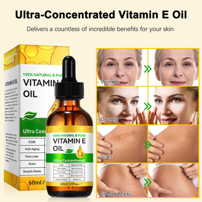 flasture Vitamin E Oil 75,000 IU – 100% Pure Natural Vitamin E for Skin, Face, Hair, Scars – Deep Moisturizing Body Oil for Dry Skin, Wrinkles – Cold-Pressed, Non-GMO,Skincare – 2 Fl Oz flasture