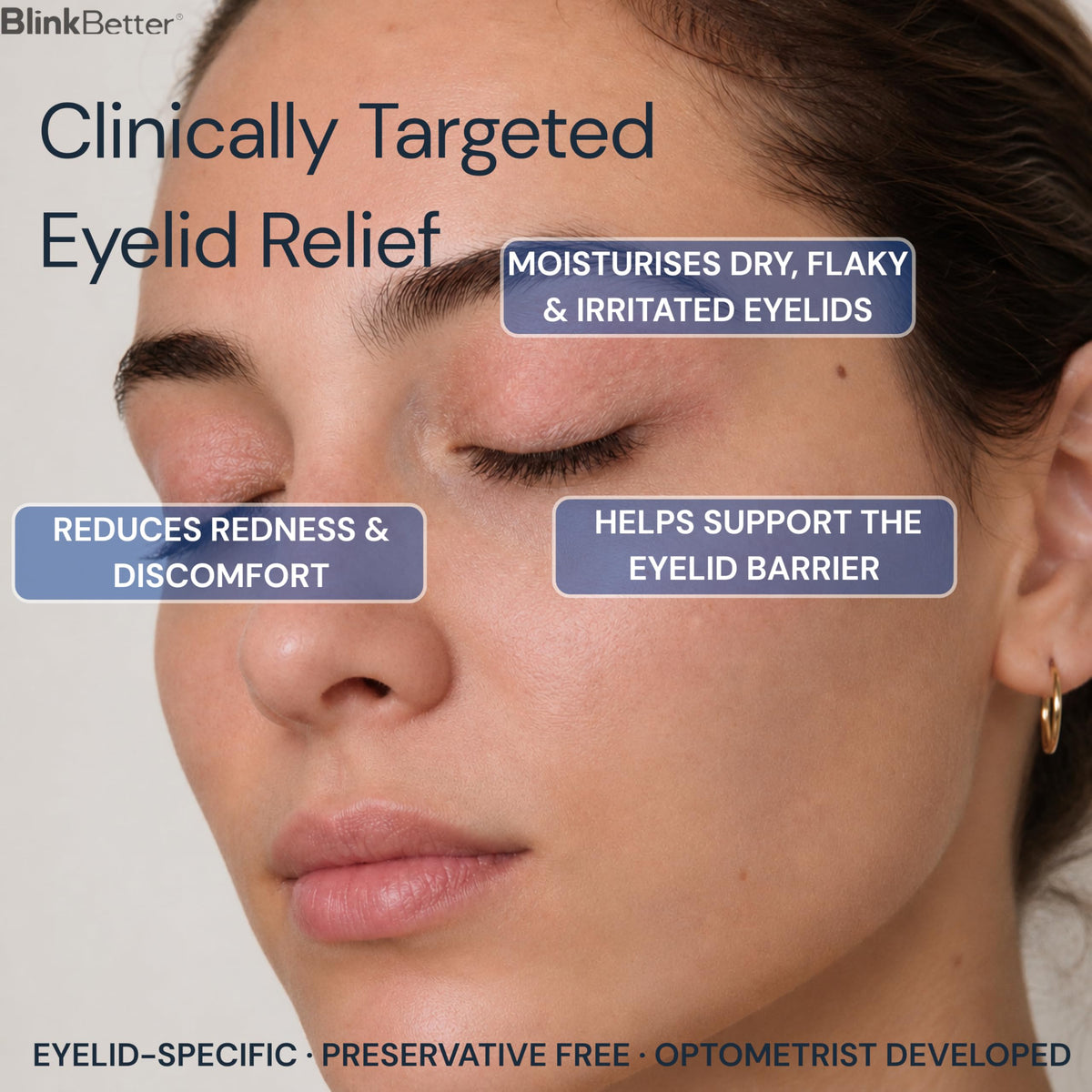 BlinkBetter BetterLids Eyelid Ointment for Dry, Itchy & Sensitive Eyelids – Deep-Moisturising Oat Complex with Shea Butter & Panthenol to Hydrate, Nourish & Soothe Delicate Eyelid Skin – 0.34 oz BlinkBetter