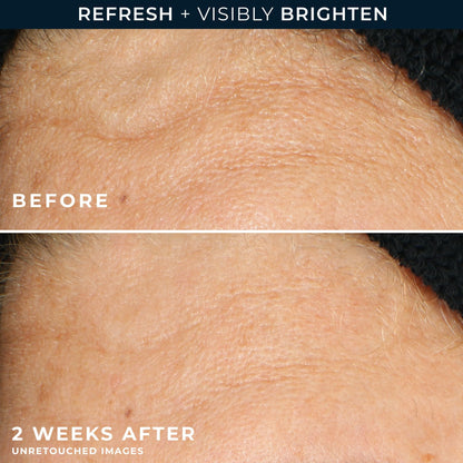 RoC Multi Correxion Revive + Glow Vitamin C Gel Brightening Cleanser, 6 oz RoC