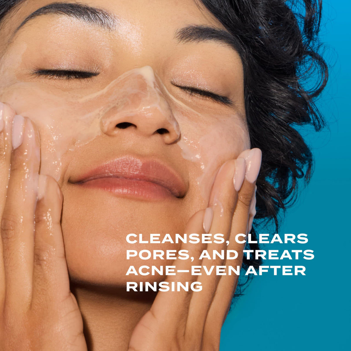 Murad Acne Control Clarifying Cleanser - Salicylic Acid - 5 Fl Oz Murad
