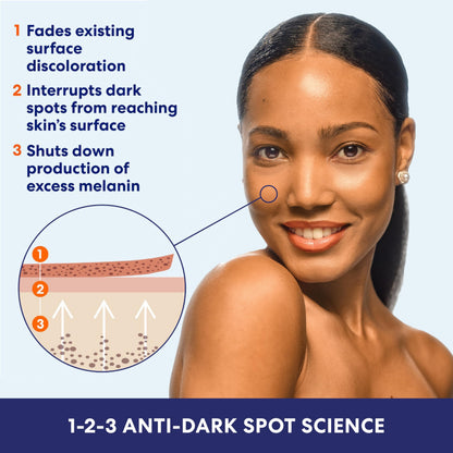 Palmer's Skin Success Anti-Dark Spot Fade Milk Body Lotion, 8.5 Ounce Palmer's