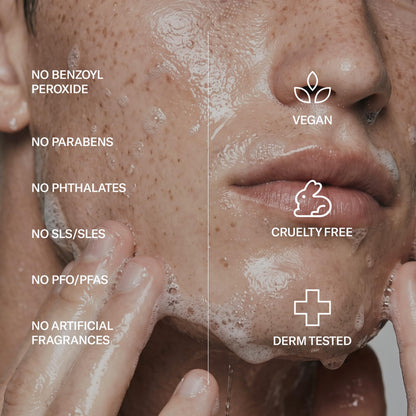Geologie Acne Control Face Wash and Anti-Pimple Pack Bundle, Salicylic Acid, Spot Treatment, Hydrocolloid Pimple Patches, BPO-Free, 2-Piece Set Geologie