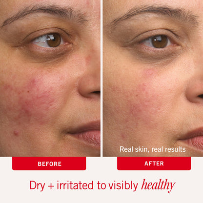 First Aid Beauty Ultra Repair Cream, Intense Hydration, 2 oz First Aid Beauty