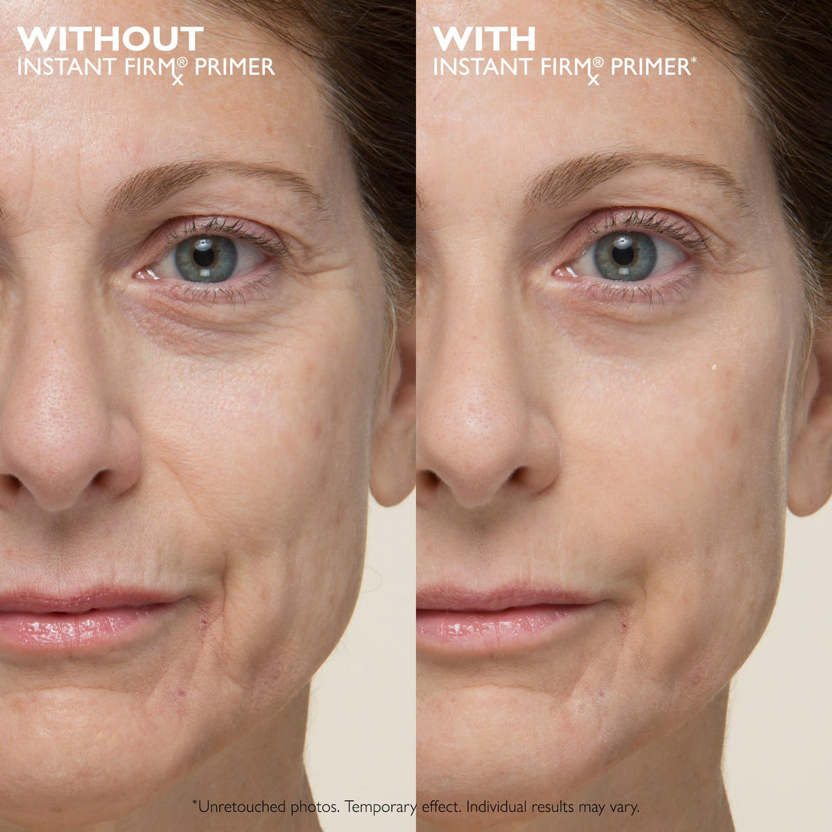 Peter Thomas Roth | Instant FIRMx® No-Filter Primer, Instant Skin Tightener, Skin Firmer, Makeup Primer For Face, Blurring Face Primer Peter Thomas Roth