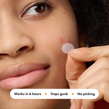 Mighty Patch Hero Cosmetics Variety Pack of Acne Pimple Patches, 26 Ct Mighty Patch