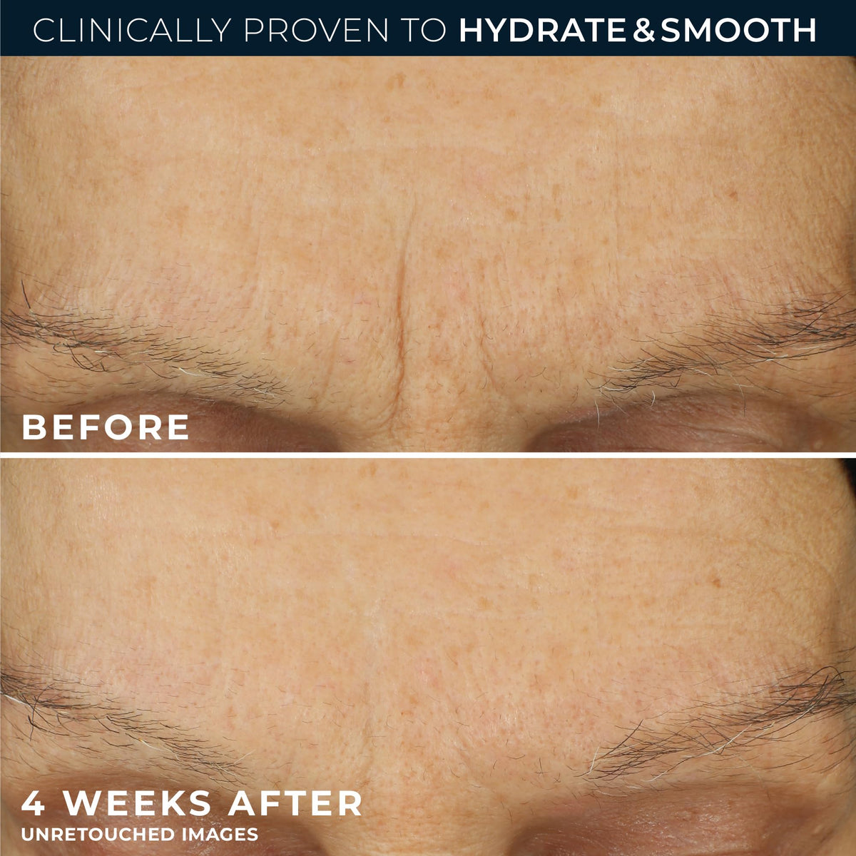 RoC Retinol Correxion Max Daily Hydration Face Moisturizer, Hyaluronic Acid RoC