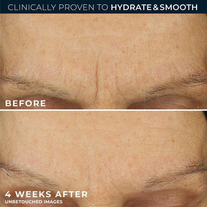 RoC Retinol Correxion Max Daily Hydration Face Moisturizer, Hyaluronic Acid RoC