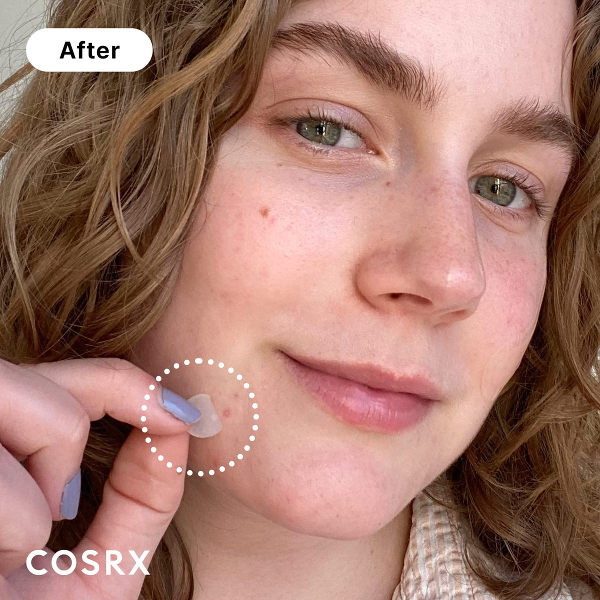COSRX Acne Pimple Patches Absorbing Hydrocolloid Spot, 3 Size (48 Count) COSRX