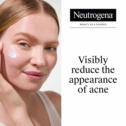 Neutrogena Rapid Clear Stubborn Acne Spot Treatment Gel, 1 oz Neutrogena