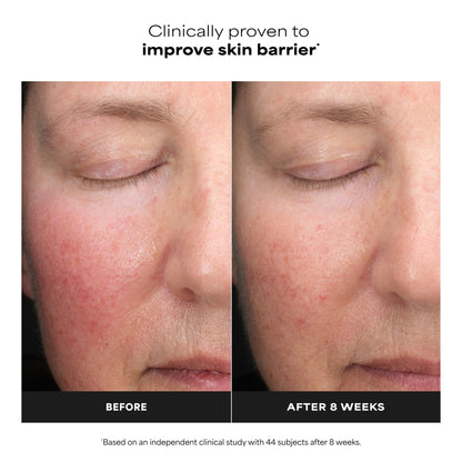 Paula's Choice 6% Mandelic + 2% Lactic Acid Liquid Exfoliant, 3 Fl Oz Paula's Choice