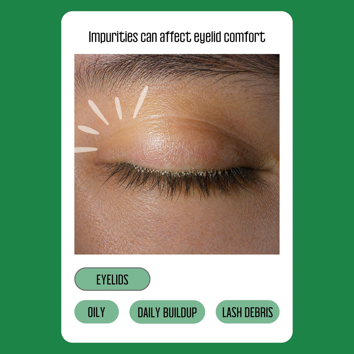 PURELID 100PCs Tea Tree Eyelid Wipes – Cleaning Eye Wipes for People with Dry Eyes & Allergies – Gentle Eyelid Cleanser with Hyaluronic Acid, Chamomile and Aloe – Individually Wrapped & Biodegradable PURELID
