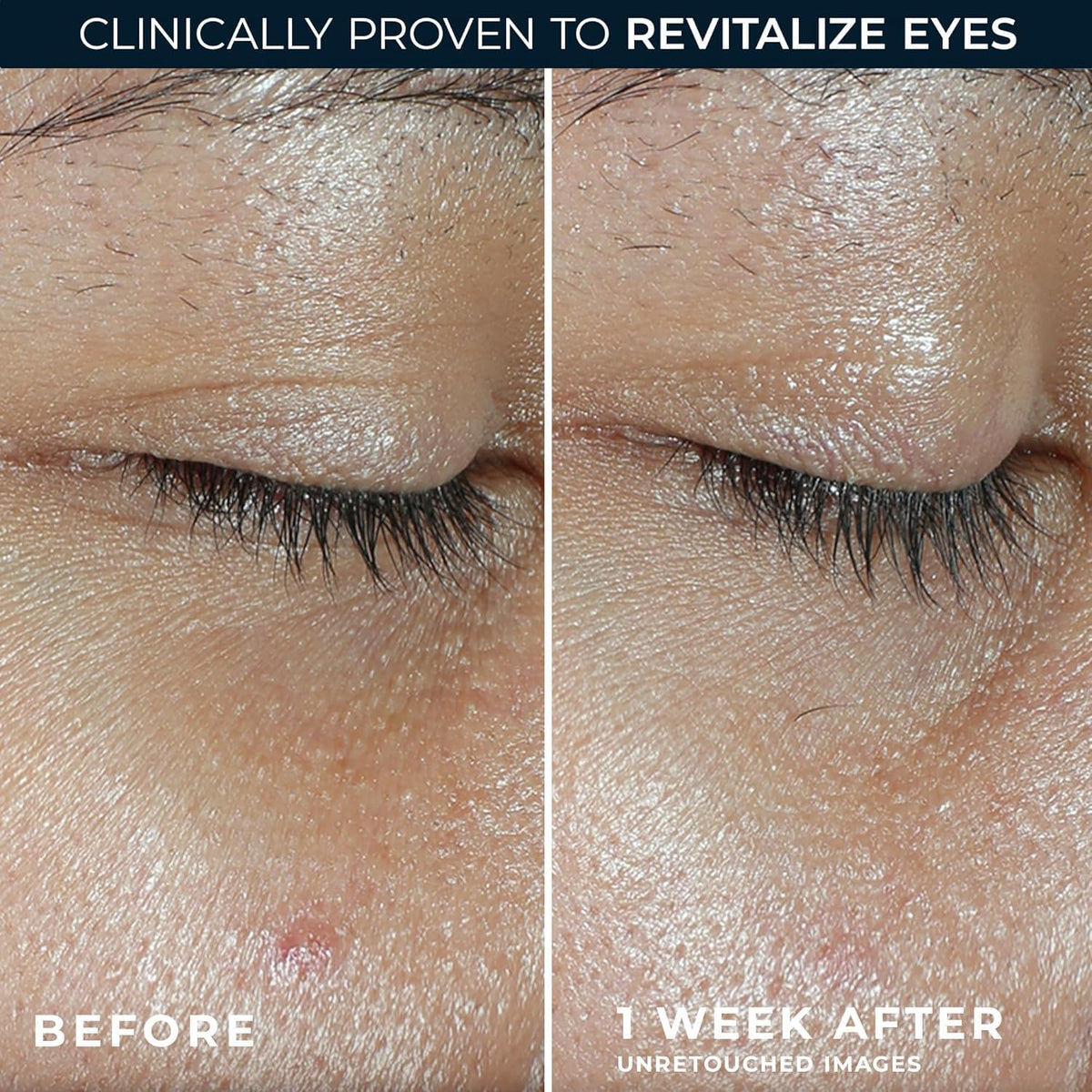 RoC Multi Correxion Revive + Glow Eye Balm with Vitamin C (0.14 oz) + Retinol Eye Cream Packette RoC