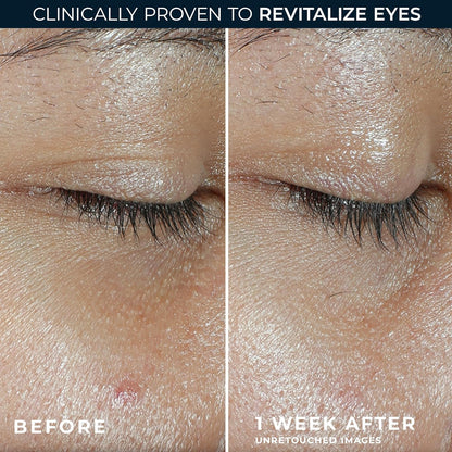 RoC Multi Correxion Revive + Glow Eye Balm with Vitamin C (0.14 oz) + Retinol Eye Cream Packette RoC