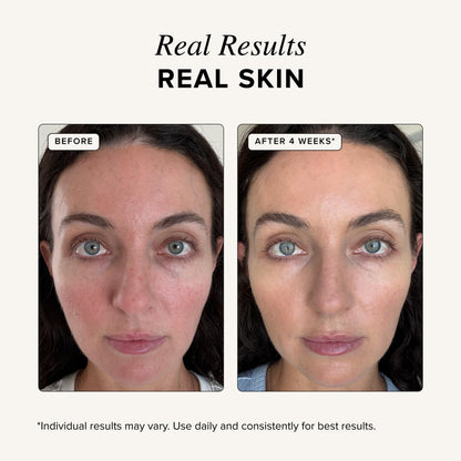 Asterwood Copper Peptides Serum for Face, GHK-Cu Peptide w/Hyaluronic Acid Asterwood