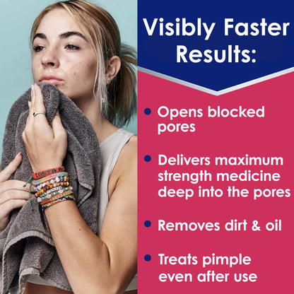 Clearasil Rapid Rescue Deep Treatment Acne Face Pads, Maximum Strenght with 2% Salicylic Acid Acne Treatment Medicine, 90 Count Clearasil