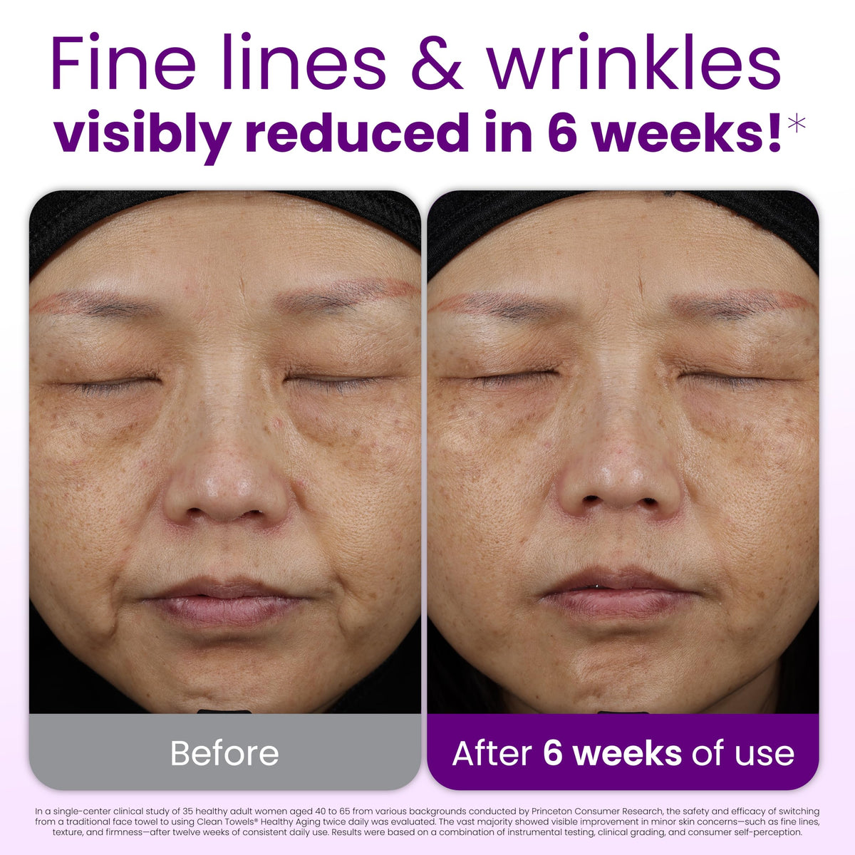 Reduces Fine Lines and Wrinkles in 6 weeks or Less, CLEAN SKIN CLUB Healthy Aging Clean Towels® XL, Disposable Face Towels, XL - 1 Pack (50 count) CLEAN SKIN CLUB