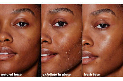 e.l.f. SKIN Gentle Peeling Exfoliant, Cleanser, Effective, Easy to Apply, Peels Away Dead Skin, Removes Dirt, Ideal for All Skin Types e.l.f.
