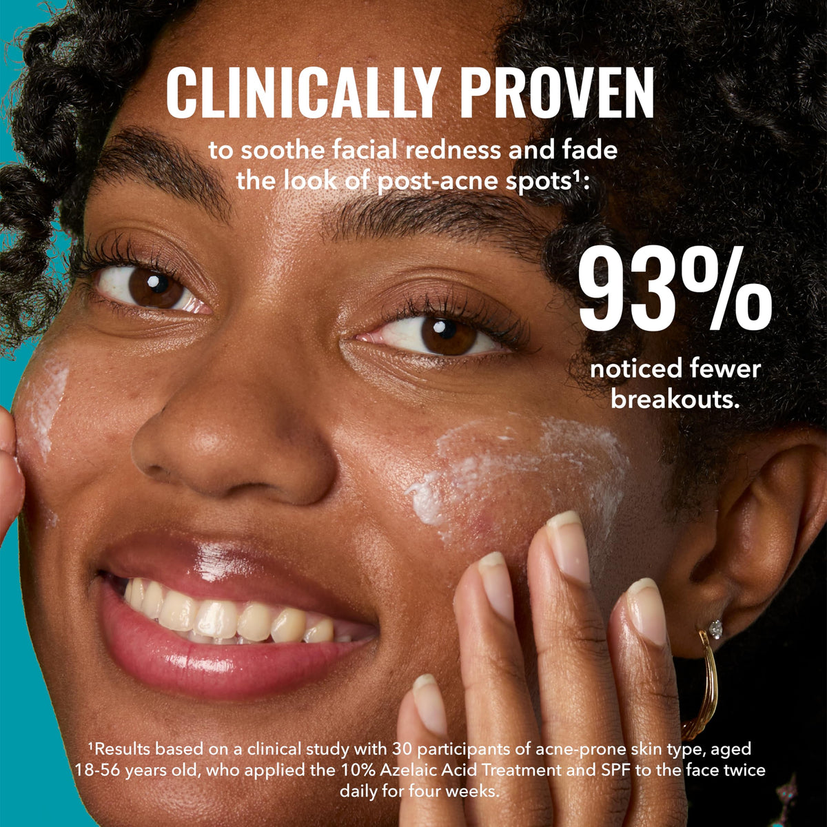Good Molecules 10% Azelaic Acid Treatment for Face – Blurs Facial Redness & Evens Skin Tone – Brightens the Look of Dark Spots & Refines Texture – Vegan & Fragrance-Free Skincare (30ml / 1.01 fl oz.) Good Molecules