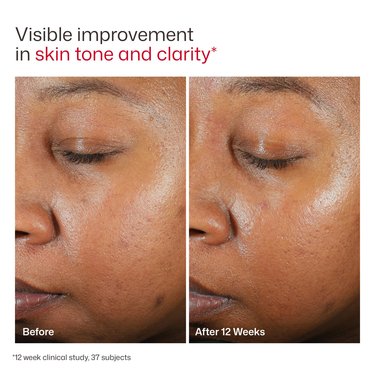 EltaMD UV Clear Untinted Face Sunscreen with Zinc Oxide, SPF 46, 1.7 oz EltaMD